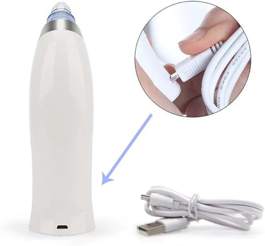 Blackhead Remover Pore Vacuum for face