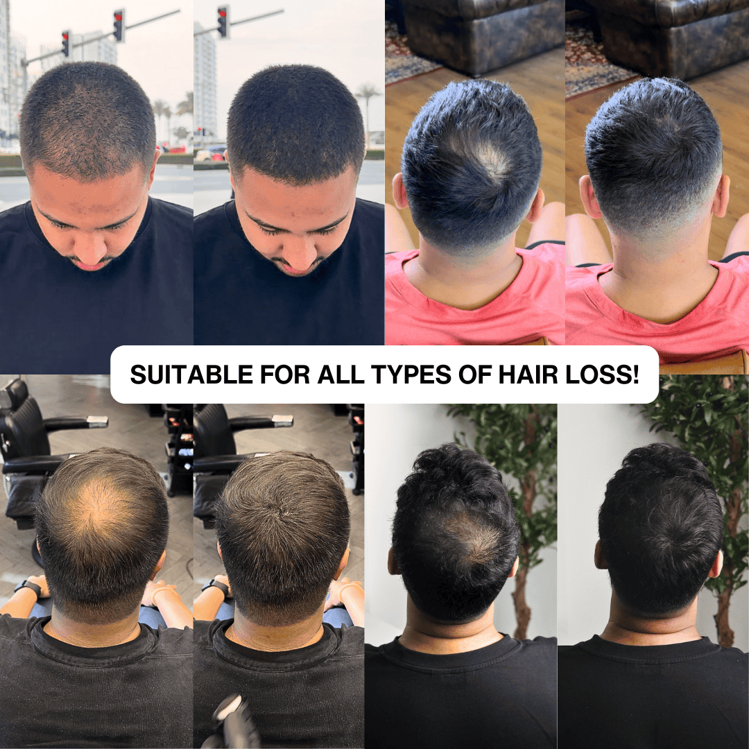 Hair Filler Powder – Instant Root Touch-Up & Hairline Coverage