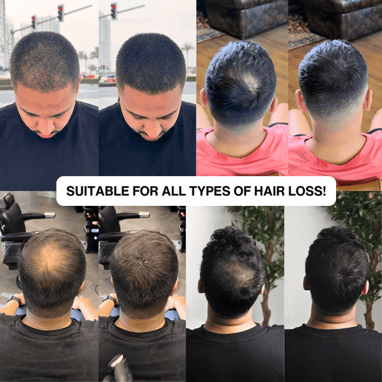 Hair Filler Powder – Instant Root Touch-Up & Hairline Coverage