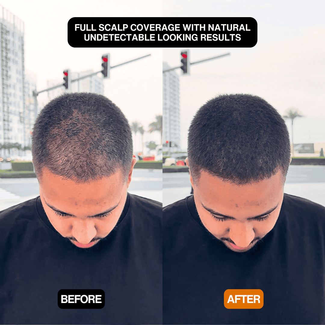 Hair Filler Powder – Instant Root Touch-Up & Hairline Coverage